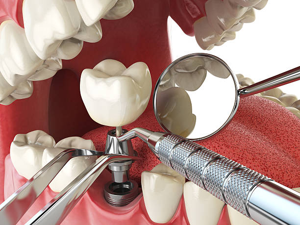 Best After-Hours Dental Trauma Care in Ina, IL